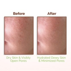 Mamaearth Rice Water Dewy Face Toner with Rice Water & 4% Niacinamide