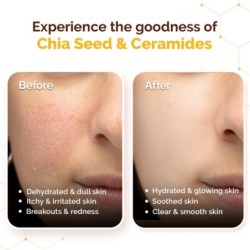 Mamaearth Chia Calming Sunscreen with Chia Seed & Ceramides